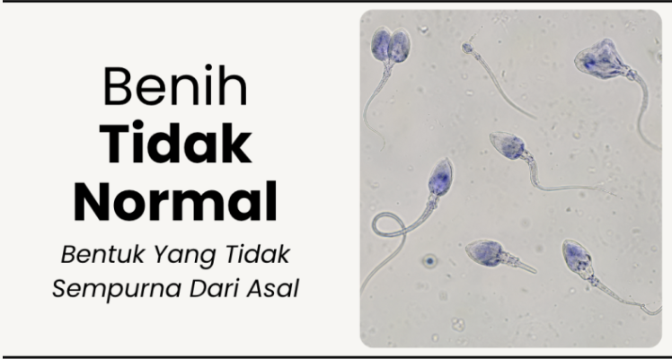 Air Terlalu Cair
